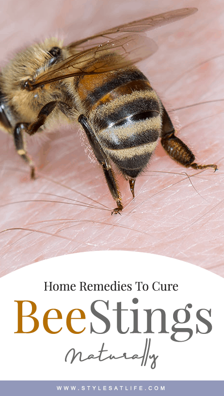 Arı sokması için ev ilaçları