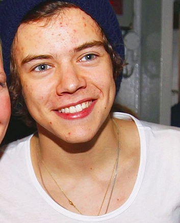 makyajsız harry stilleri