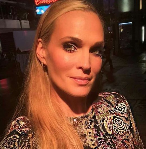 Molly Sims'in burun şekli