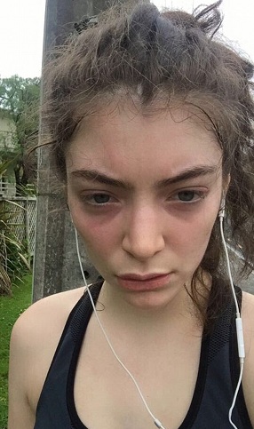 Lorde'un Makyajsız Resimleri 4