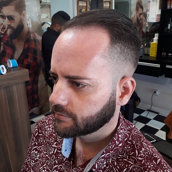 vyrų šukuosenos nuplikimas