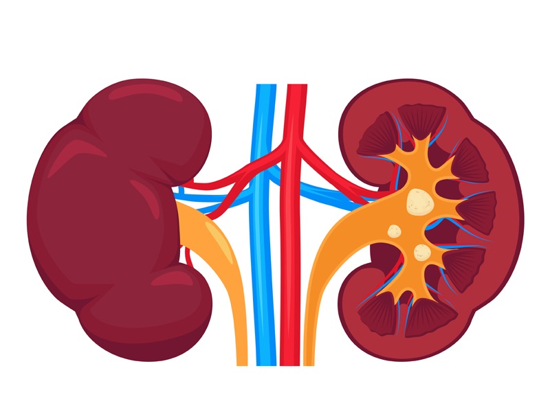 Böbrek Taşları İçin Doğal Ev Çözümleri