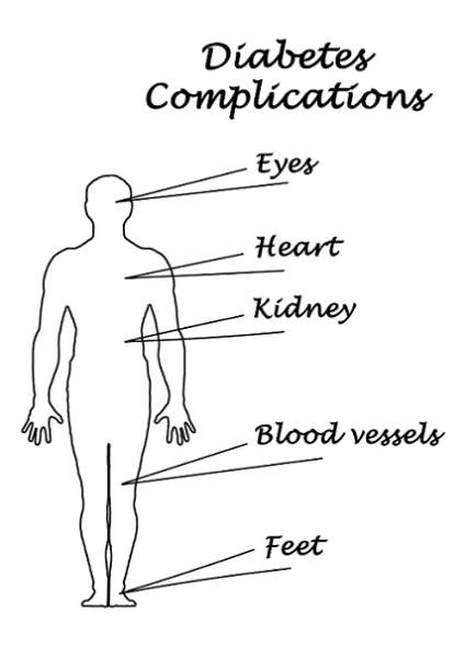 Diabeto komplikacijos