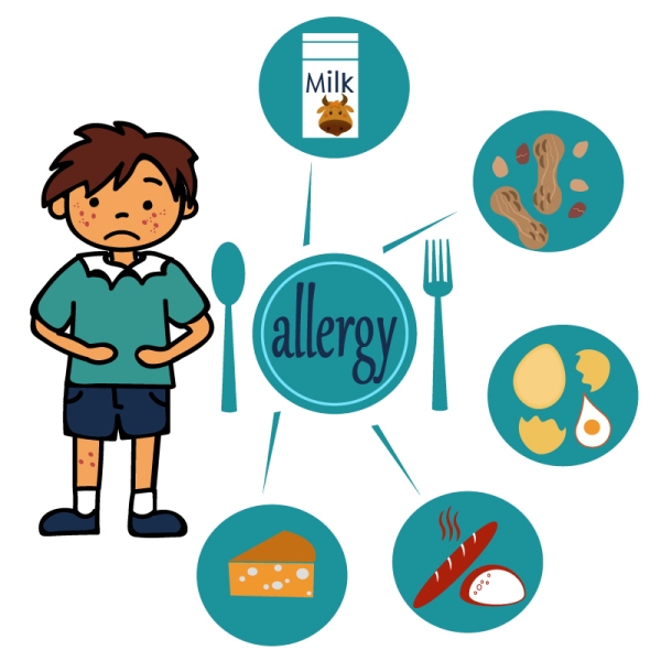 alergijos maistui simptomai