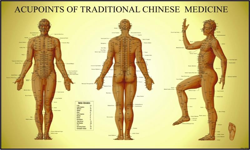 Κινεζικός βελονισμός δείχνει ολόκληρο το σώμα κινεζική ιατρική