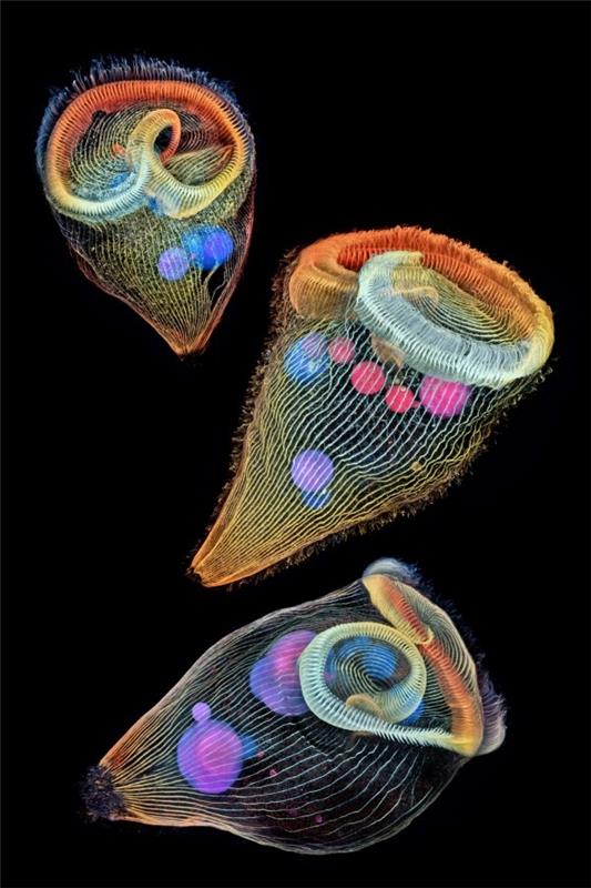 Οι νικήτριες φωτογραφίες από τη Nikon Small World 2019 είναι εδώ! τρία stentors ζώα γλυκού νερού δεύτερη θέση