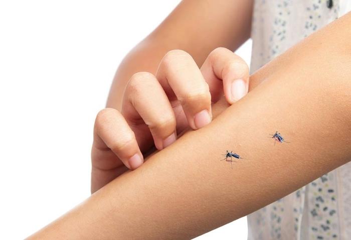 Αντιμετωπίστε τις θεραπείες στο σπίτι για τσιμπήματα κουνουπιών