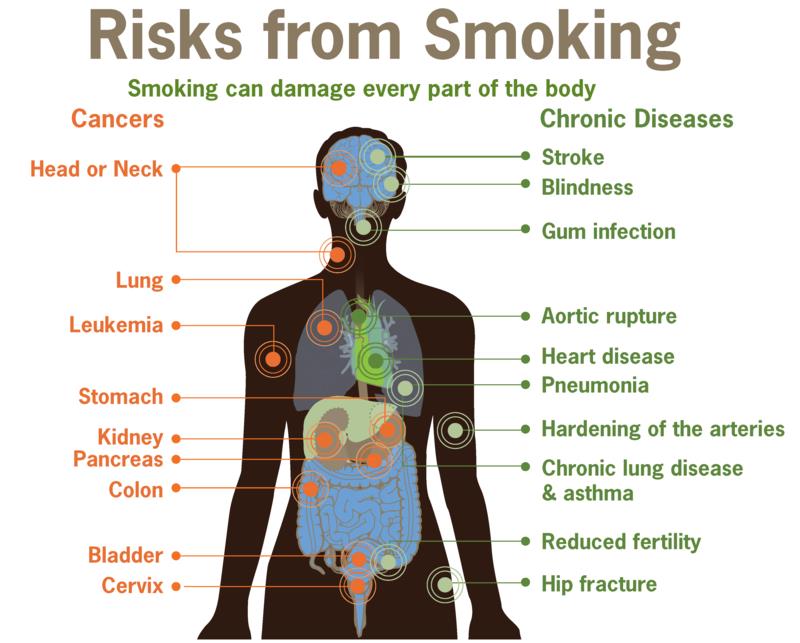 Η καρδιακή προσβολή αποτρέπει τους κινδύνους καπνίσματος