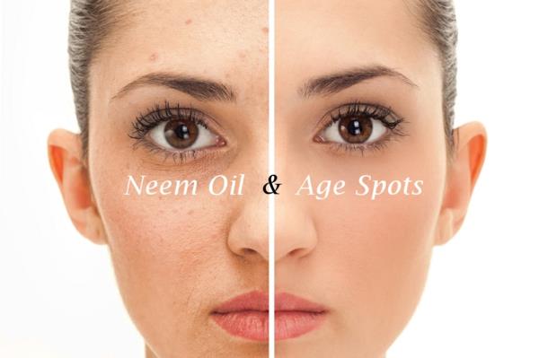 Neem Oil Neem Oil Neem Tree φύλλα και φρούτα