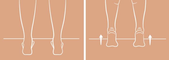 Ασκήσεις επίπεδων ποδιών θεραπεία επίπεδων ποδιών