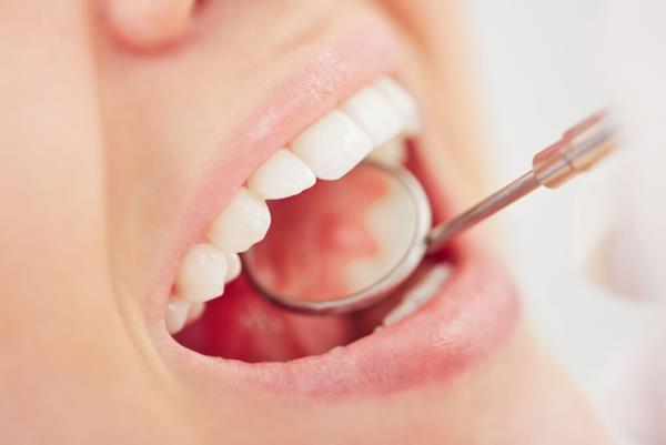 Συμβουλές για υγιή ούλα και όμορφο χαμόγελο υγιή δόντια οδοντίατρος