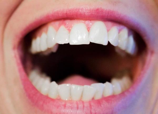 Συμβουλές για υγιή ούλα και όμορφο χαμόγελο καλή στοματική υγιεινή λευκά δόντια