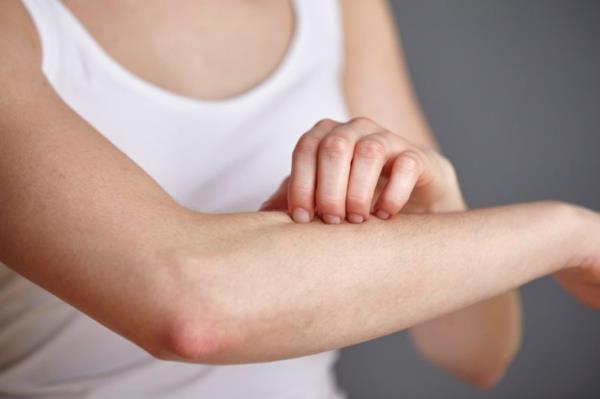 Τι βοηθάει στα κνησμώδη συμπτώματα του δέρματος
