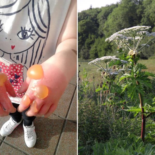 το hogweed αναγνωρίζει τον κίνδυνο