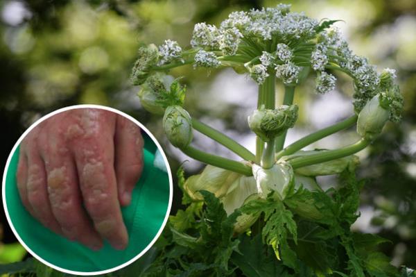 Αναγνωρίστε το hogweed δηλητηριώδες