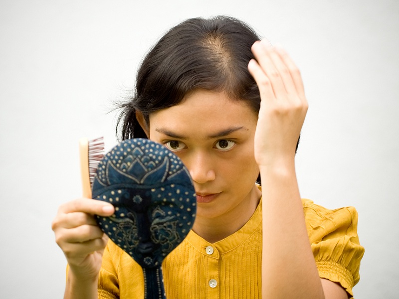 Plaukų slinkimo namų gynimo priemonės