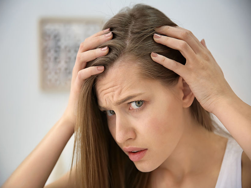 Evde Saç Kellik Tedavisi Nasıl Yapılır?