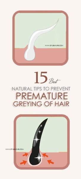 Kaip išvengti ankstyvo plaukų slinkimo