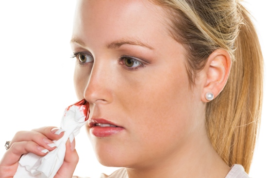 Kraujavimo iš nosies simptomai