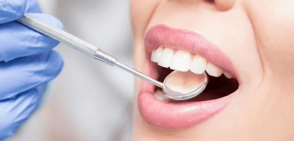 επαγγελματική οδοντική προφύλαξη καθαρισμού δοντιών