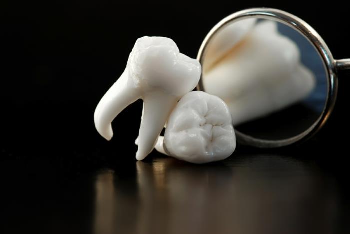 Η σωστή οδοντιατρική φροντίδα αποφεύγει τα αίτια της τερηδόνας