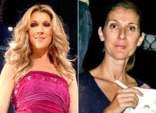 Celine Dion Makyajsız 4