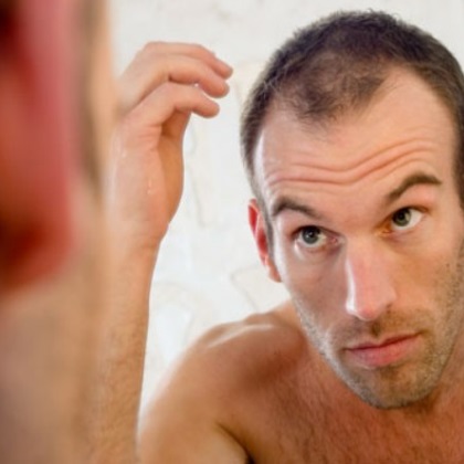 Kaip DHT sukelia plaukų slinkimą