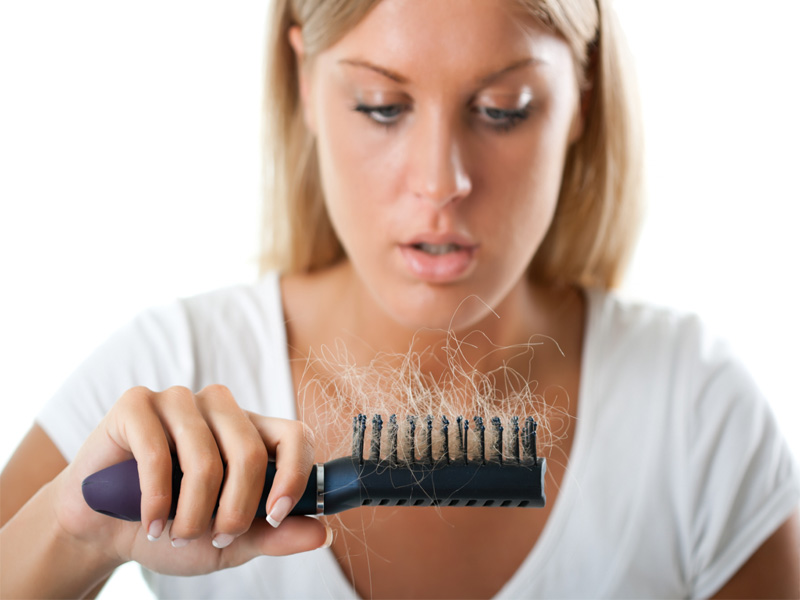Kas sukelia Dht plaukų slinkimą ir kaip jį gydyti