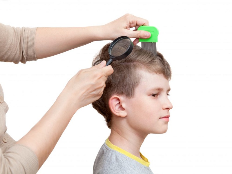 Plaukų slinkimo priežastys vaikams