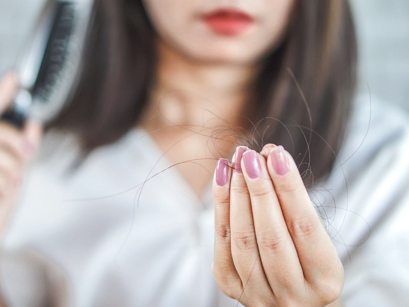 Staigaus plaukų slinkimo priežastys