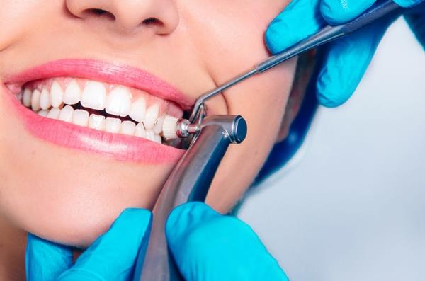 επαγγελματική οδοντιατρική προφύλαξη